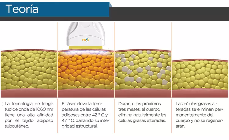 Diodo Láser Shape Corporal