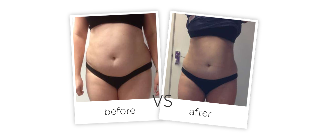 Contorno Corporal Representación