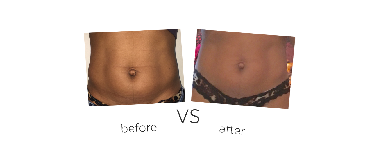 Contorno Corporal Tabla de comparación