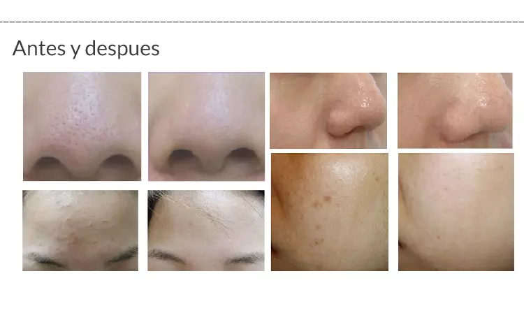 Multi-función Limpieza Facial Profunda
