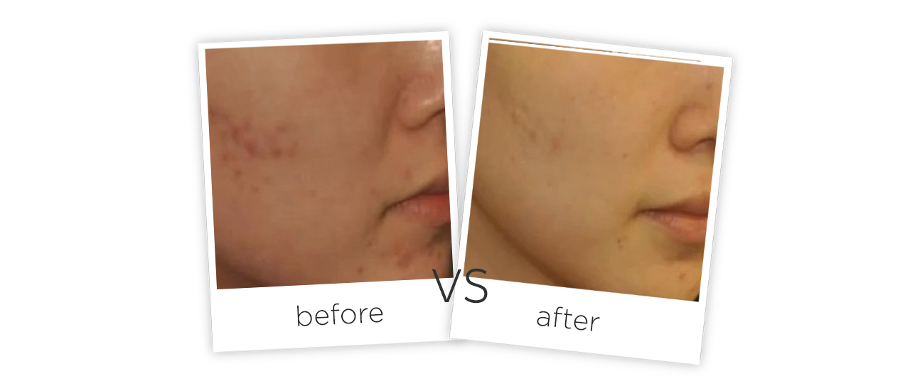 Cuidado Dario Facial Representación