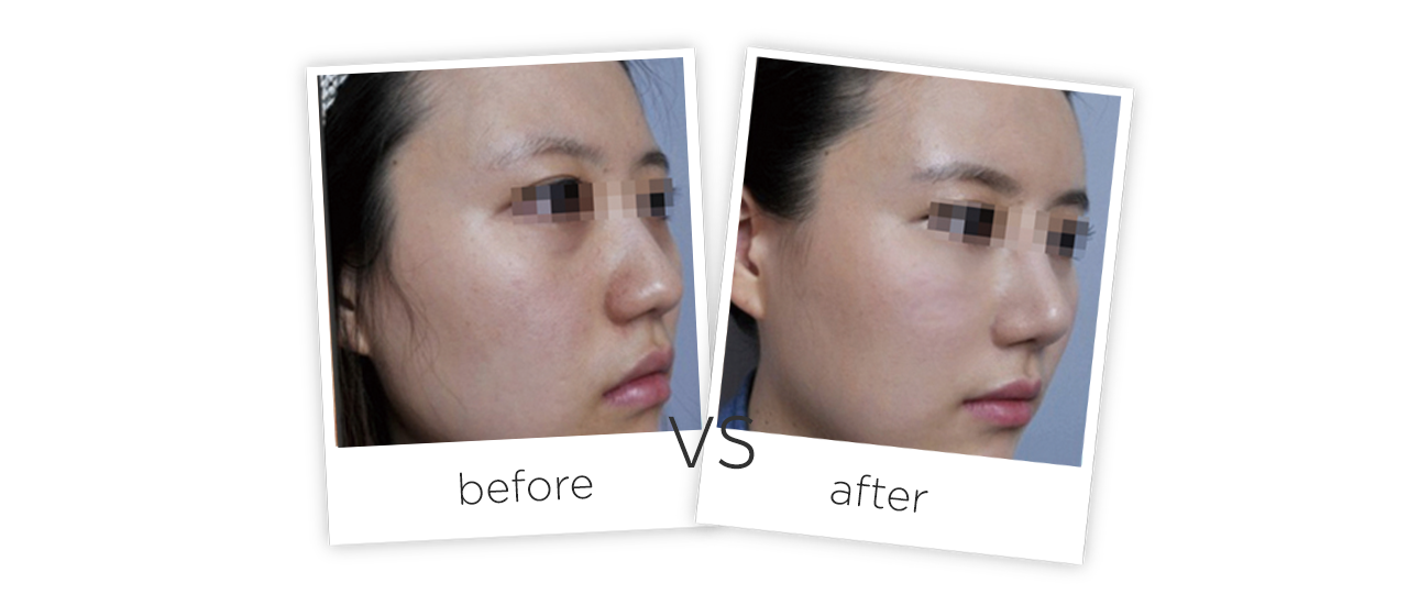 Cuidado Dario Facial Tabla de comparación