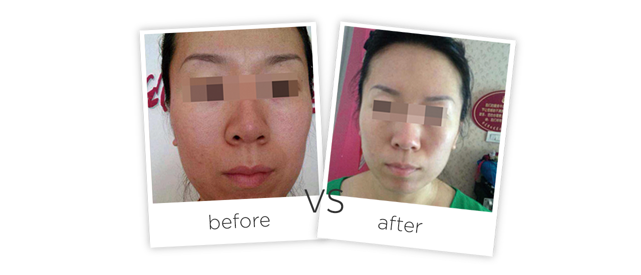 Cuidado Dario Facial Antes y despues