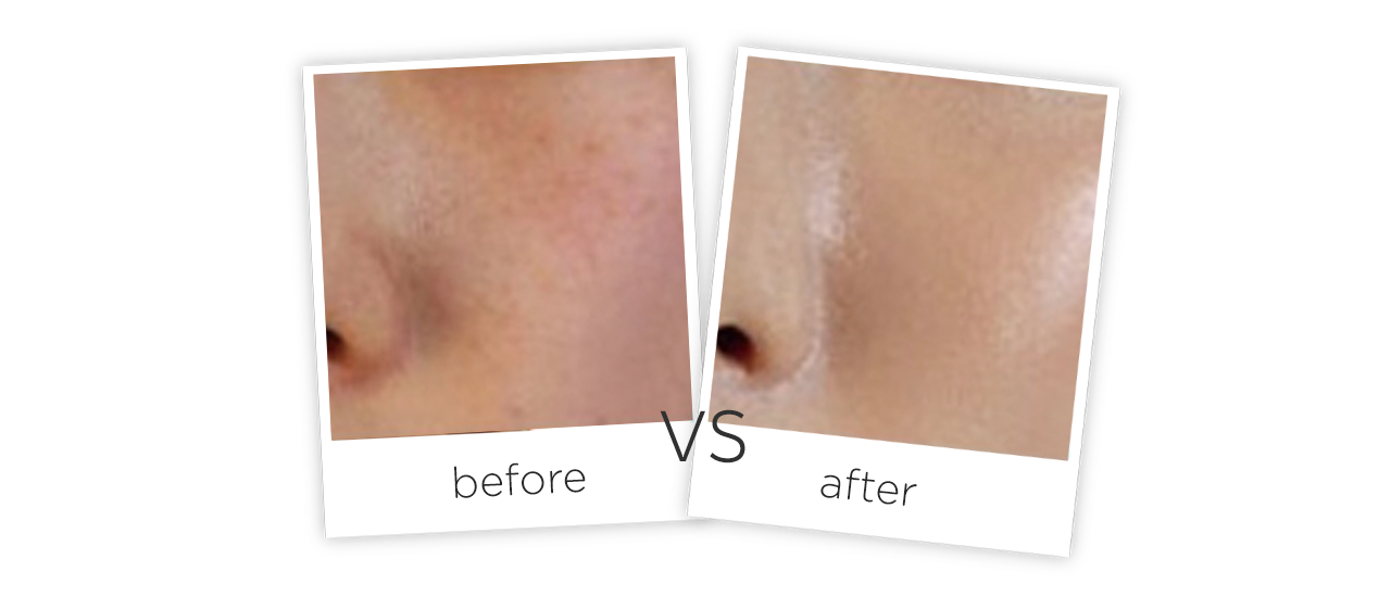 Cuidado Dario Facial Antes y despues