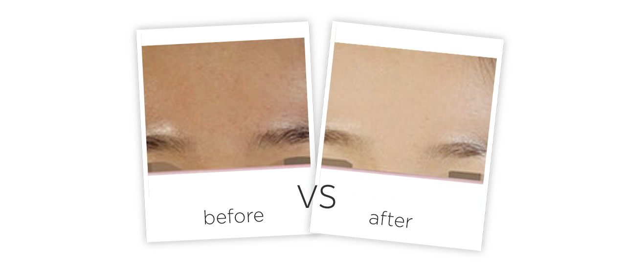 Cuidado Dario Facial Antes y despues
