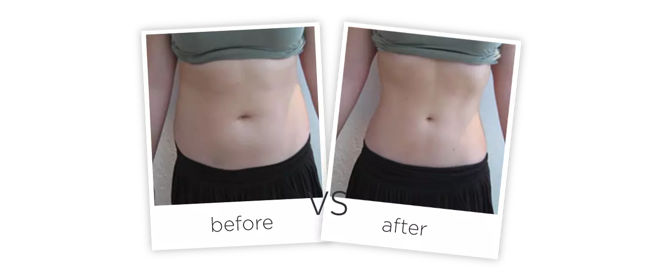 Vacuum Shape ,VS+ Antes y despues