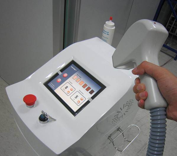 OPT Depilación Máquina Precio